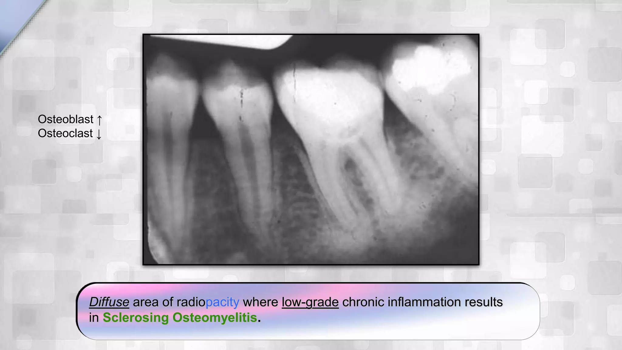 Radiographic findings of Endodontic lesions | PPSX