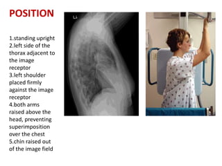 basics of chest xray | PPTX
