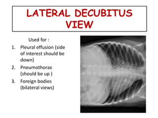 basics of chest xray | PPTX