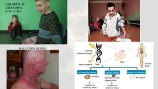 CHILDREN OF
CHERNOBYL
SURVIVORS
RADIATION BURNS
 