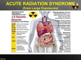 ACUTE RADIATION SYNDROME
(from Large Exposures)
 