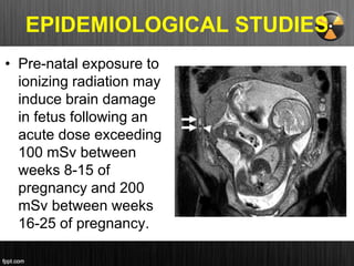 EPIDEMIOLOGICAL STUDIES
• Pre-natal exposure to
ionizing radiation may
induce brain damage
in fetus following an
acute dose exceeding
100 mSv between
weeks 8-15 of
pregnancy and 200
mSv between weeks
16-25 of pregnancy.
 