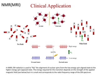 NMR(MRI) Clinical Application
In NMR, EM radiation is used to "flip" the alignment of nuclear spins from the low energy spin aligned state to the
higher energy spin opposed state. The energy required for this transition depends on the strength of the applied
magnetic field (see below) but in is small and corresponds to the radio frequency range of the EM spectrum.
 
