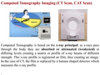 Computed Tomography is based on the x-ray principal: as x-rays pass
through the body they are absorbed or attenuated (weakened) at
differing levels creating a matrix or profile of x-ray beams of different
strength. This x-ray profile is registered on film, thus creating an image.
In the case of CT, the film is replaced by a banana shaped detector which
measures the x-ray profile.
.
Computed Tomography Imaging (CT Scan, CAT Scan)
 