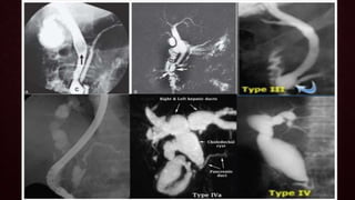Radioanatomy of biliary system | PPTX