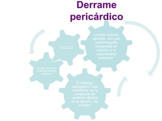Derrame pericárdico corazón grande, globular, con una cardiomegalia exagerada en relación a la vascularidad pulmonar  