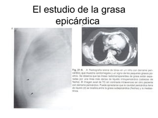El estudio de la grasa epicárdica  
