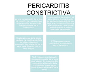 PERICARDITIS CONSTRICTIVA 