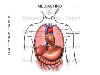 MEDIASTINO MEDIASTINO 