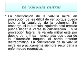 La  calcificación de la válvula mitral en proyección pa. es difícil de ver porque queda justo a la izquierda de la columna. Sin embargo, si la aurícula izquierda está crecida puede llegar a verse la calcificación. En la proyección lateral, la válvula mitral está por debajo de la línea mencionada que pasa de la bifurcación traqueal al borde anterior diafragmático. La calcificación de la válvula mitral es prácticamente siempre secundaria a enfermedad reumática. 
