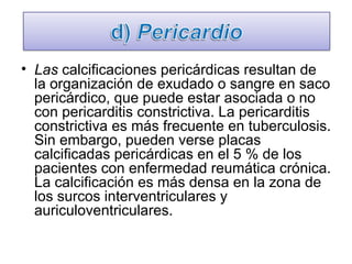 Las  calcificaciones pericárdicas resultan de la organización de exudado o sangre en saco pericárdico, que puede estar asociada o no con pericarditis constrictiva. La pericarditis constrictiva es más frecuente en tuberculosis. Sin embargo, pueden verse placas calcificadas pericárdicas en el 5 % de los pacientes con enfermedad reumática crónica. La calcificación es más densa en la zona de los surcos interventriculares y auriculoventriculares. 