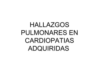 HALLAZGOS PULMONARES EN CARDIOPATIAS ADQUIRIDAS  