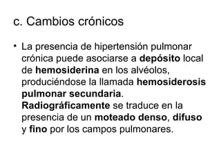 c. Cambios crónicos  La presencia de hipertensión pulmonar crónica puede asociarse a  depósito  local de  hemosiderina  en los alvéolos, produciéndose la llamada  hemosiderosis   pulmonar secundaria .  Radiográficamente  se traduce en la presencia de un  moteado denso ,  difuso  y  fino  por los campos pulmonares. 