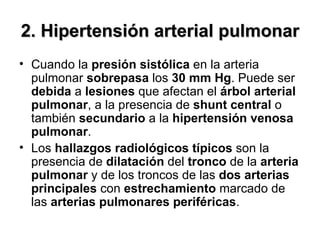 2.  Hipertensión arterial pulmonar  Cuando la  presión sistólica  en la arteria pulmonar  sobrepasa  los  30 mm Hg . Puede ser  debida  a  lesiones  que afectan el  árbol arterial pulmonar , a la presencia de  shunt central  o también  secundario  a la  hipertensión venosa pulmonar . Los  hallazgos   radiológicos   típicos  son la presencia de  dilatación  del  tronco  de la  arteria   pulmonar  y de los troncos de las  dos   arterias   principales  con  estrechamiento  marcado de las  arterias   pulmonares   periféricas . 