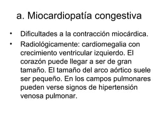 a. M iocardiopatía congestiva  Dificultades a la contracción miocárdica.  Radiológicamente: cardiomegalia con crecimiento ventricular izquierdo. El corazón puede llegar a ser de gran tamaño. El tamaño del arco aórtico suele ser pequeño. En los campos pulmonares pueden verse signos de hipertensión venosa pulmonar. 