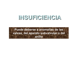 INSUFICIENCIA Puede deberse a anomalías de las valvas, del aparato subvalvular o del anillo 