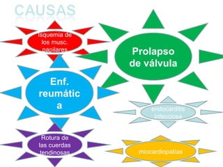 Isquemia de los musc. papilares Prolapso de válvula Enf. reumática endocarditis infecciosa miocardiopatías Rotura de las cuerdas tendinosas 