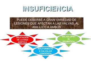 INSUFICIENCIA PUEDE DEBERSE A GRAN VARIEDAD DE LESIONES QUE AFECTAN A LAS VALVAS, AL ANILLO O A AMBOS DILATACIÓN DE LA RAIZ AÓRTICA VALVULOPATÍA REUMÁTICA MALFORMACIÓN VALVULAR CONGÉNITA 