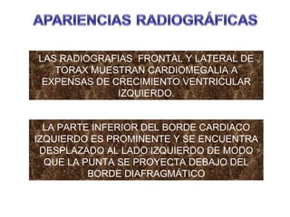 LAS RADIOGRAFIAS  FRONTAL Y LATERAL DE TORAX MUESTRAN CARDIOMEGALIA A EXPENSAS DE CRECIMIENTO VENTRICULAR IZQUIERDO. LA PARTE INFERIOR DEL BORDE CARDIACO IZQUIERDO ES PROMINENTE Y SE ENCUENTRA DESPLAZADO AL LADO IZQUIERDO DE MODO QUE LA PUNTA SE PROYECTA DEBAJO DEL BORDE DIAFRAGMÁTICO 