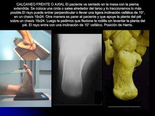 Radioanatomia Del Pie Y Tobillo PDF radioanatomia-del-pie-y-tobillo-pdf
