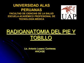 UNIVERSIDAD ALAS
       PERUANAS
 FACULTAD DE CIENCIAS DE LA SALUD
ESCUELA ACADÉMICO PROFESIONAL DE
       TECNOLOGÍA MÉDICA




RADIOANATOMIA DEL PIE Y
       TOBILLO
           Lic. Antonio Lozano Contreras
                      HNCASE
 