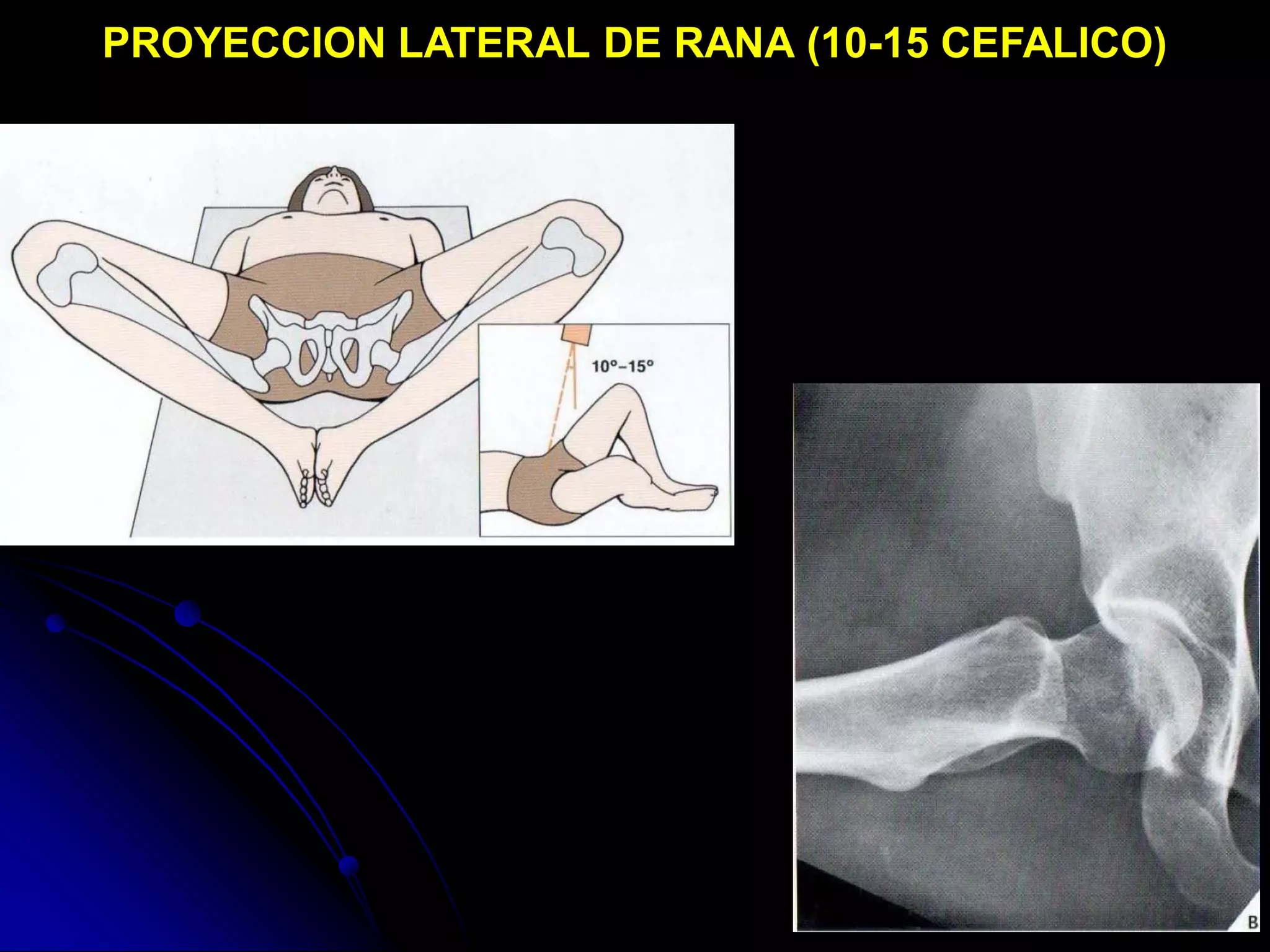 Lowenstein Rx Radioanatomia de pelvis osea | PDF