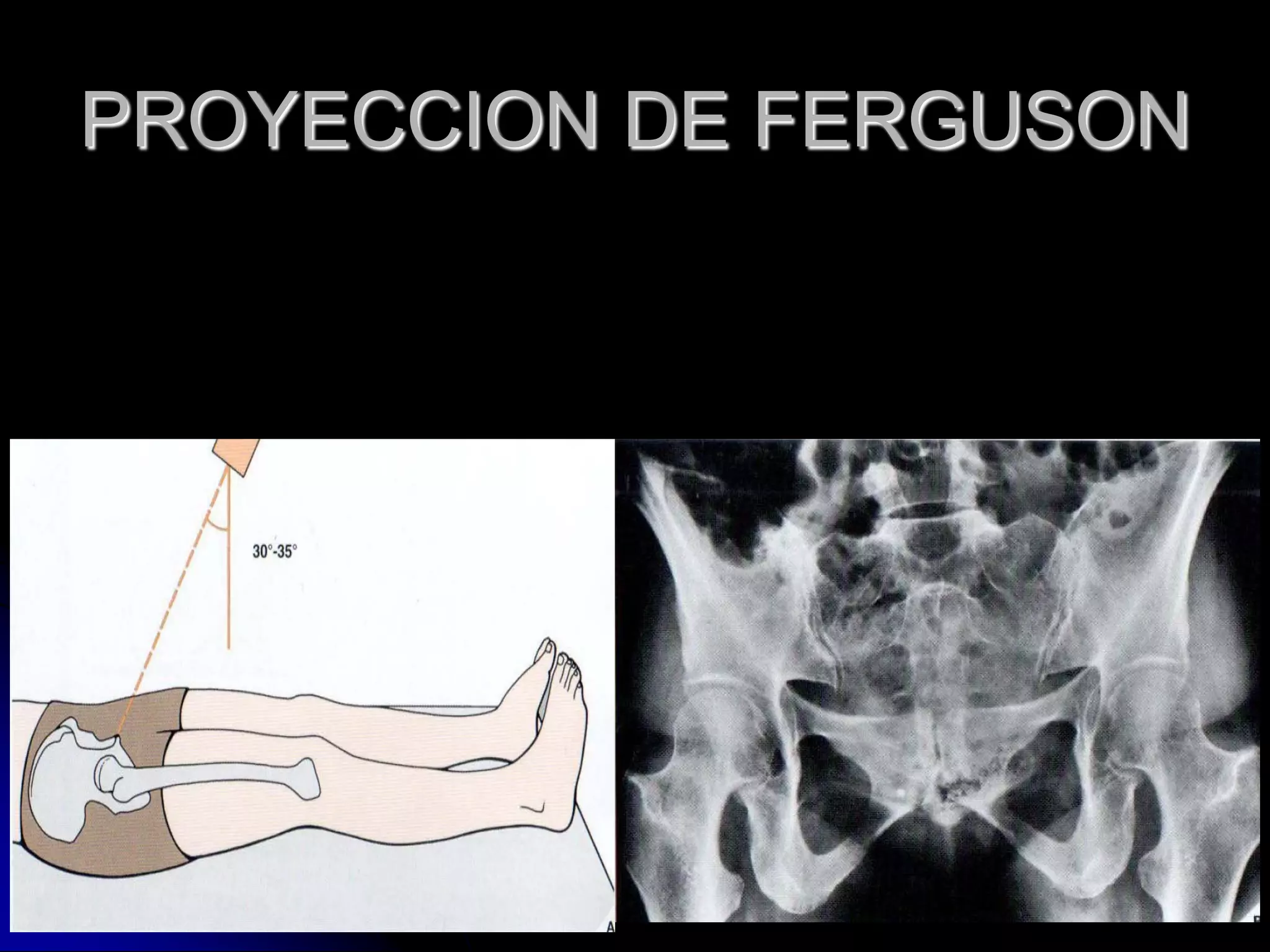 Radioanatomia de pelvis osea | PDF