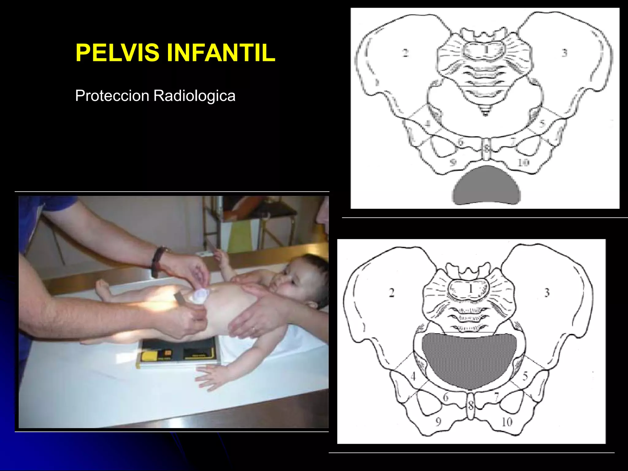 Lowenstein Rx Radioanatomia de pelvis osea | PDF