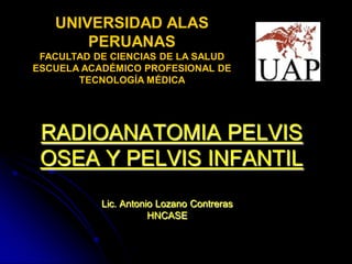 UNIVERSIDAD ALAS
       PERUANAS
 FACULTAD DE CIENCIAS DE LA SALUD
ESCUELA ACADÉMICO PROFESIONAL DE
       TECNOLOGÍA MÉDICA




 RADIOANATOMIA PELVIS
 OSEA Y PELVIS INFANTIL
           Lic. Antonio Lozano Contreras
                      HNCASE
 