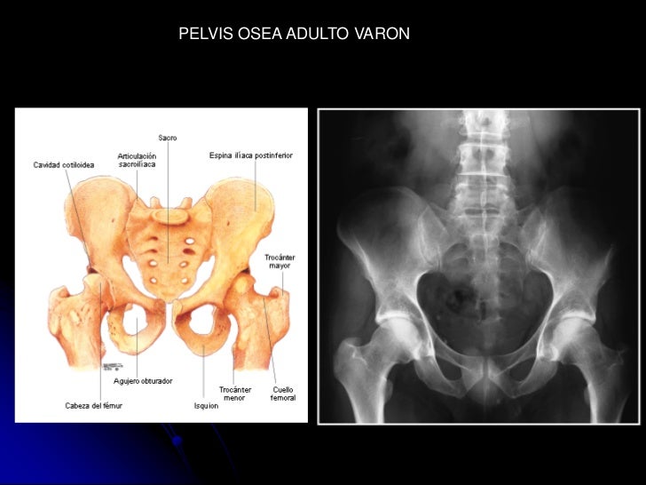 Radioanatomia de pelvis osea