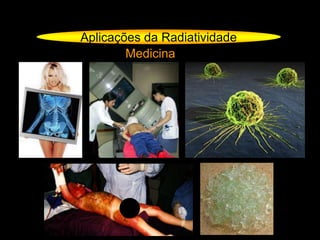 Aplicações da Radiatividade
Medicina
 