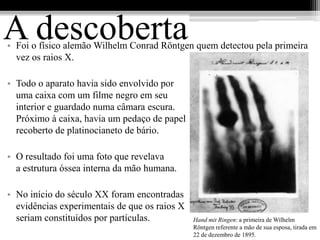 A descoberta
• Foi o físico alemão Wilhelm Conrad Röntgen quem detectou pela primeira
  vez os raios X.

• Todo o aparato havia sido envolvido por
  uma caixa com um filme negro em seu
  interior e guardado numa câmara escura.
  Próximo à caixa, havia um pedaço de papel
  recoberto de platinocianeto de bário.

• O resultado foi uma foto que revelava
  a estrutura óssea interna da mão humana.

• No início do século XX foram encontradas
  evidências experimentais de que os raios X
  seriam constituídos por partículas.          Hand mit Ringen: a primeira de Wilhelm
                                               Röntgen referente a mão de sua esposa, tirada em
                                               22 de dezembro de 1895.
 