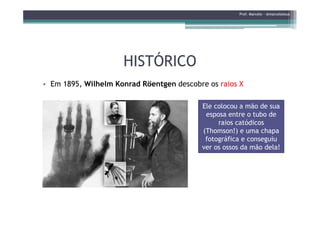 HISTÓRICOHISTÓRICO
• Em 1895, Wilhelm Konrad Röentgen descobre os raios X
Prof. Marcelo - @marceloteus
Ele colocou a mão de sua
esposa entre o tubo deesposa entre o tubo de
raios catódicos
(Thomson!) e uma chapa
fotográfica e conseguiu
ver os ossos da mão dela!
 