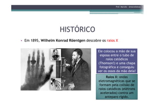 HISTÓRICOHISTÓRICO
• Em 1895, Wilhelm Konrad Röentgen descobre os raios X
Prof. Marcelo - @marceloteus
Ele colocou a mão de sua
esposa entre o tubo deesposa entre o tubo de
raios catódicos
(Thomson!) e uma chapa
fotográfica e conseguiu
ver os ossos da mão dela!
Raios X: ondas
eletromagnéticas que se
formam pela colisão de
raios catódicos (elétrons
acelerados) contra um
anteparo rígido.
 
