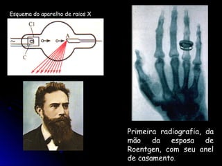 Esquema do aparelho de raios X




                                 Primeira radiografia, da
                                 mão    da   esposa    de
                                 Roentgen, com seu anel
                                 de casamento.
 