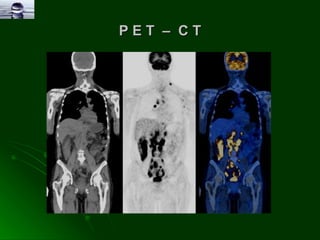 P E T  –  C T 