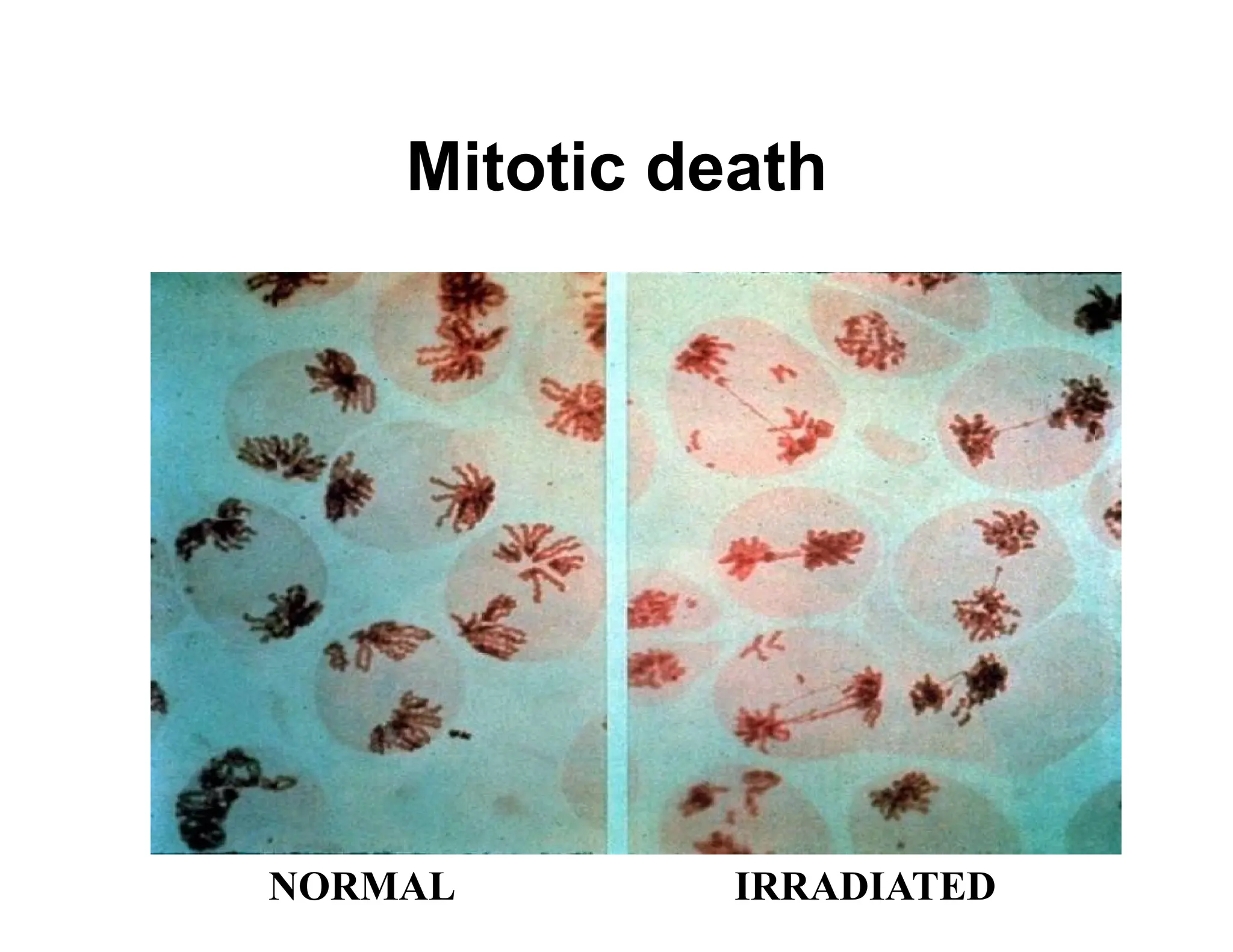 NORMAL IRRADIATED
Mitotic death
 
