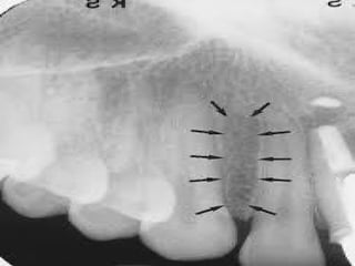 Radio dental anatomy 6,7 ppt teaching how radio anatomy worksin | PPTX