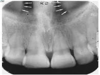 Radio dental anatomy 6,7 ppt teaching how radio anatomy worksin | PPTX