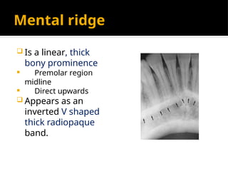 Midline Ridge Muscle Radio dental anatomy 6,7 ppt teaching how radio anatomy worksin | PPTX