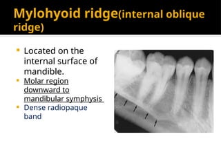 Radio dental anatomy 6,7 ppt teaching how radio anatomy worksin | PPTX