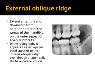 Radio dental anatomy 6,7 ppt teaching how radio anatomy worksin | PPTX