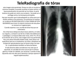 TeleRadiografia de tórax
esta imagen esta penetrada. Porque en ella se visualza la
columna completa. Se puede visualizar el boton aórtico, la
buena penetración nos permite ver los hileos, la aorta
torácica se puede ver como una curvatura. Se puede ver el
cartílago carina, los bronquios principales.
Hay que recordar que la teleradiografia se utiliza para ver la
silueta cardiaca y los pulmones. Los pulmones se evalúan
en incidencia PA (OJO CON ESTO, EL QUE PONGA AP ESTA
QUEMADO) para sacar el máximo necesario de esta placa
es necesario el negatoscopio.
Cuando vayamos a ver una Rdx de tórax hay que ser
sistematico
. De arriba hacia debajo de afuera hacia adentro, en todos
sus angulos, y comparo cual de los 2 lados esta defectuoso
o patológico. La traquea debe estar recta, entre T5 y T6 se
ve la división de la carina, esta imagen esta muy penetrada.
Hay unas placas llamadas kodak inside, estas placas son
especificas para ver el mediastino, los hilios y desplazan las
incidencias apicolordoticas que se hacían antes con este
fin. La apicolordosis también se llama de flexner.
El lado derecho debe considerarse mas alto que el
izquierdo, el cual debe de verse oscuro por la cámara
gástrica. Puede ser loblado, con varianzas. Cuando el lado
izquierdo esta mas alto que el derecho e porque aparece El
angulo esplenicocolico.
 