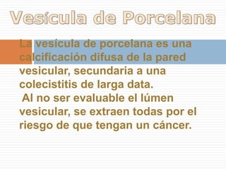 Colecistitis AgudaColecistitis Aguda LitiásicaSignos característicos:- Litiasis (cálculo impactado en el bacinete)- Engrosamiento de la pared vesicular (> de 3 mm.)- Bilis ecogénica- Dilatación en diámetro transversal > 5 mm- Signo de Murphy (+)La principal causa de colecistitis aguda es la litiasis, es muy raro que sea alitiásica.