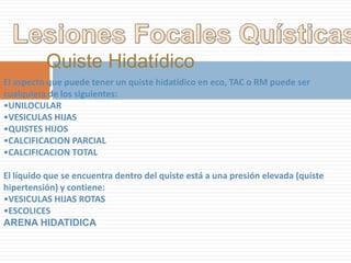 Vesícula de PorcelanaLa vesícula de porcelana es una calcificación difusa de la pared vesicular, secundaria a una colecistitis de larga data. Al no ser evaluable el lúmen vesicular, se extraen todas por el riesgo de que tengan un cáncer.