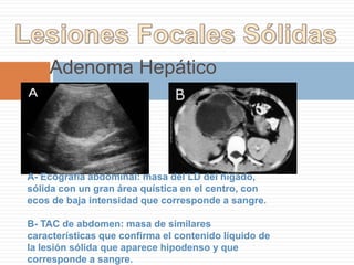 Patología del Hígado