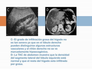 ESCOLICESARENA HIDATIDICA