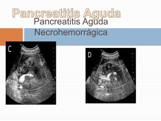 UNICO ( 90% ), MULTIPLE ( 10%)