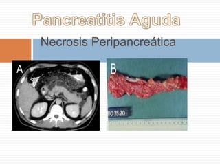 MENORES DE 3CM., ASINTOMATICOS
