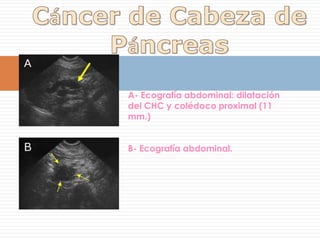 ROTURA ESPONTANEA ES RARA